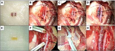 Establishment of rat allogenic vein replacement model and pathological characteristics of the replaced vessels